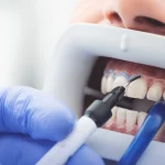 Dentist and dental care in Salou