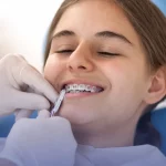 Digital smile design at Moreno Montalvo Dental Clinic Salou